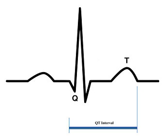 QT-interval.jpg